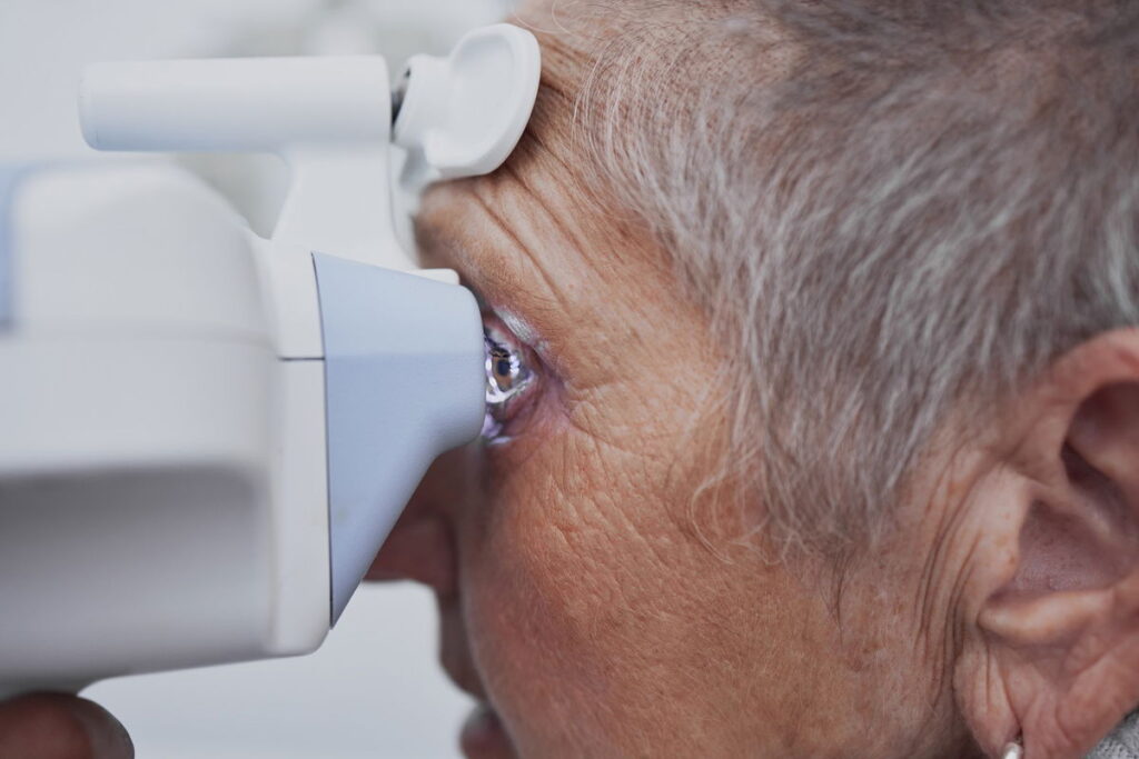 Preventing Glaucoma