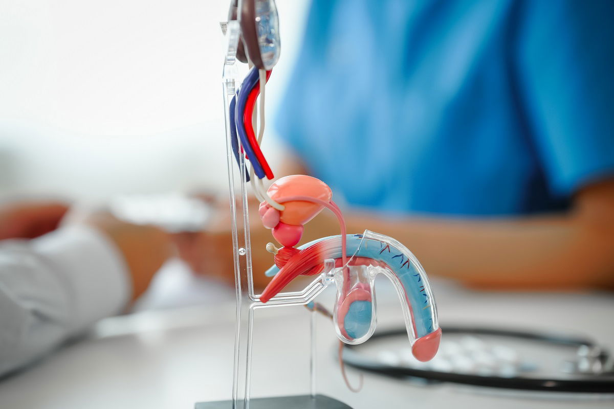 Robotic Surgery for Prostate Cancer