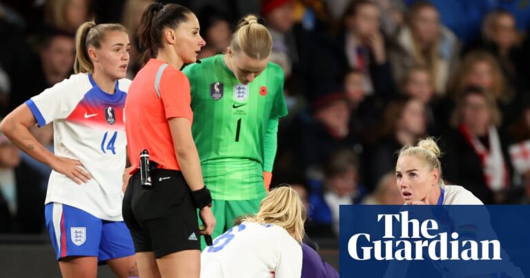 Could the ‘notch’ be key to understanding ACL injuries in women’s football?